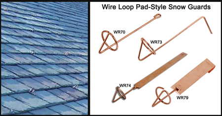 stearns-wire-loop